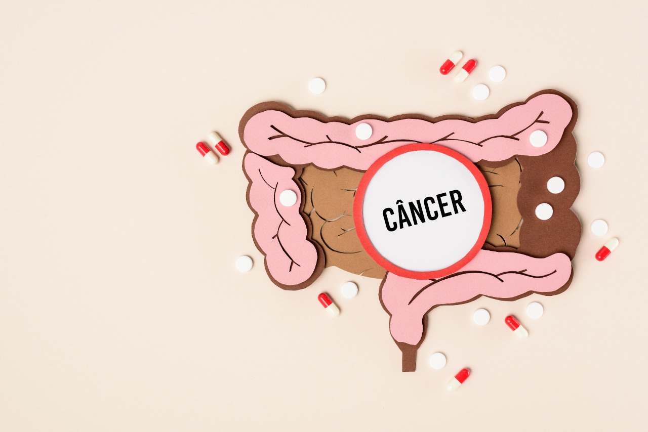 Câncer de intestino: sinais e sintomas que podem sugerir a doença