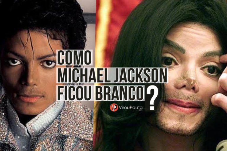 Descubra Como Michael Jackson Ficou Branco Virou Pauta