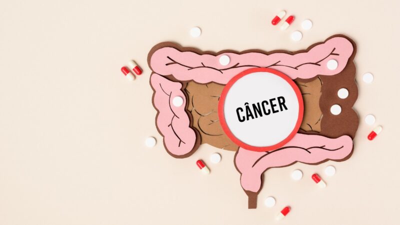 Câncer de intestino: sinais e sintomas que podem sugerir a doença